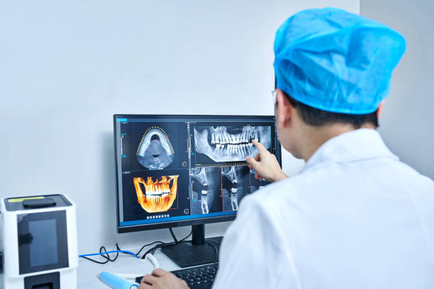 Best Chipped Tooth Repair Near Me  in Mcmillin, WA