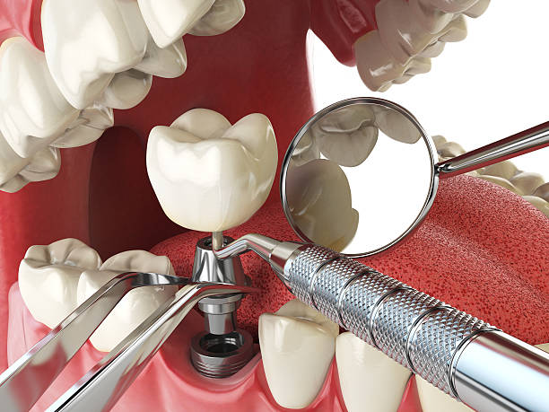 Best Emergency Gum Pain Relief  in Mcmillin, WA